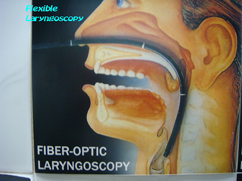 Flexible-Laryngoscopy